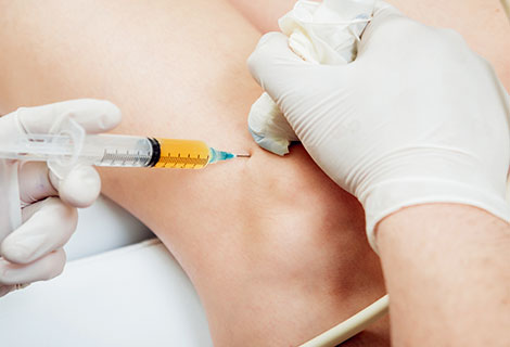 platelet-Rich Plasma Therapy Lake Mary